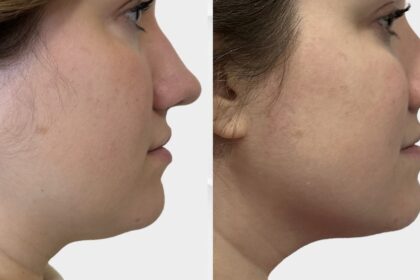 Sickscience labs shapeshift serum neck and jawline.jpg